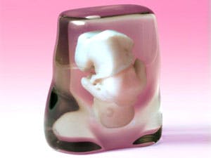 Ongeboren foetus in geschenkverpakking