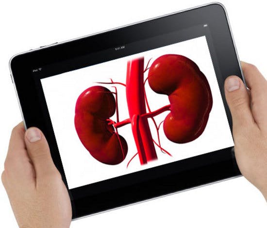 Nier verkocht voor iPad 2