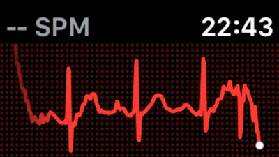 Hoe goed kan de Apple Watch 4 hartfilmpjes (ECG's) maken?