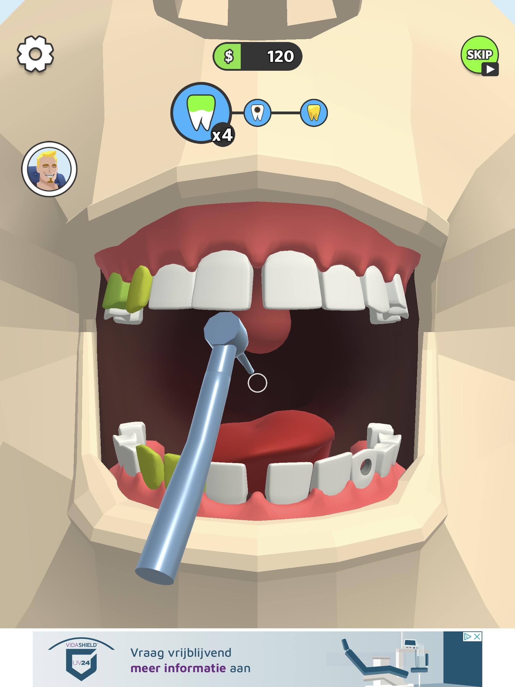 Dentist Bling - Bent u een succesvolle tandarts?