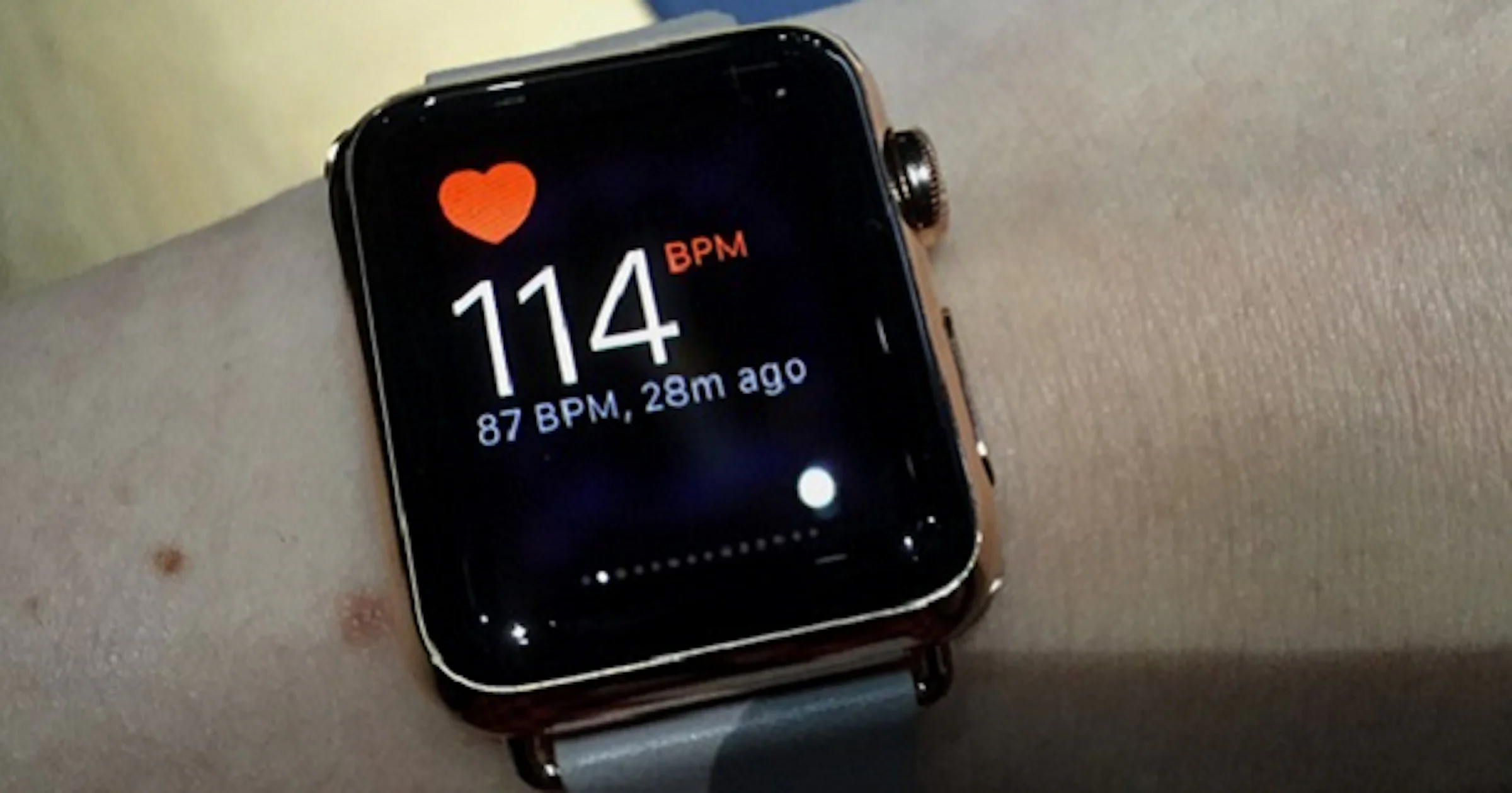 Apple Watch - Nu ik de Watch gedragen heb, wil ik hem hebben...