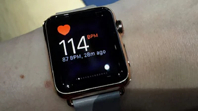 Apple Watch - Nu ik de Watch gedragen heb, wil ik hem hebben...