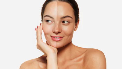 Bruin zonder zon: dit wil je weten over zelfbruiners en spraytan