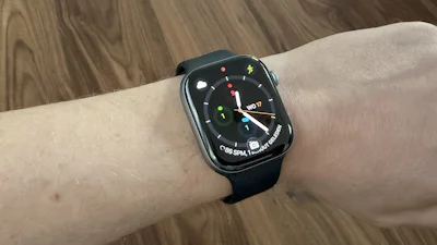 Review Apple Watch Series 11 – Kleine verbeteringen