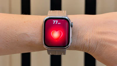 Review Huawei Watch D3 - Heeft hart voor je gezondheid