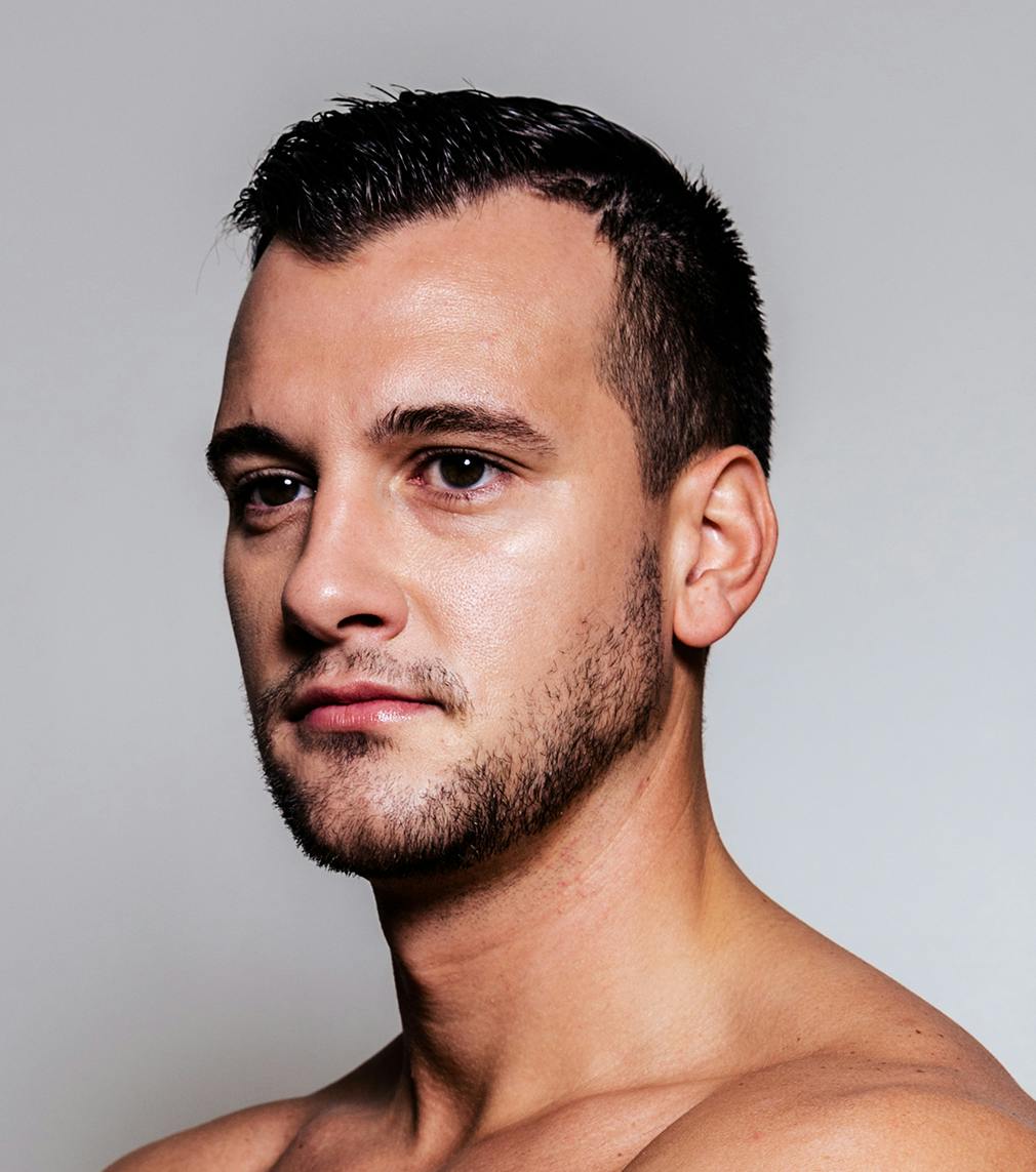 Hair Transplant (FUE) in Jacksonville, FL | PVPS
