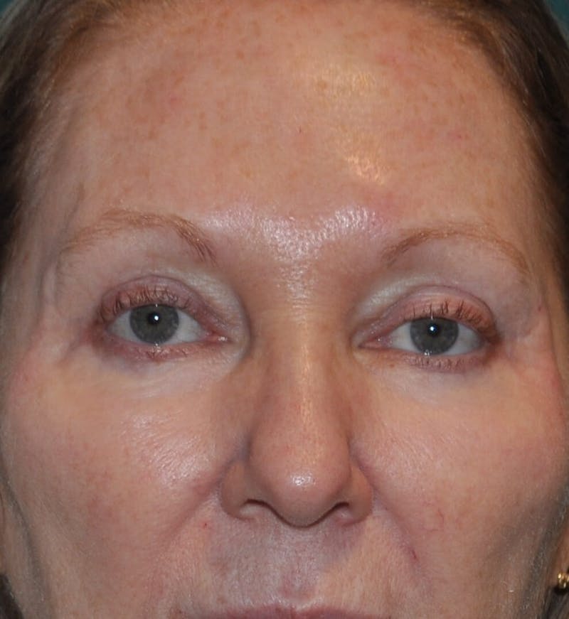 Dr. Hollie Hickman Before & After Gallery - Patient 89942795 - Image 2