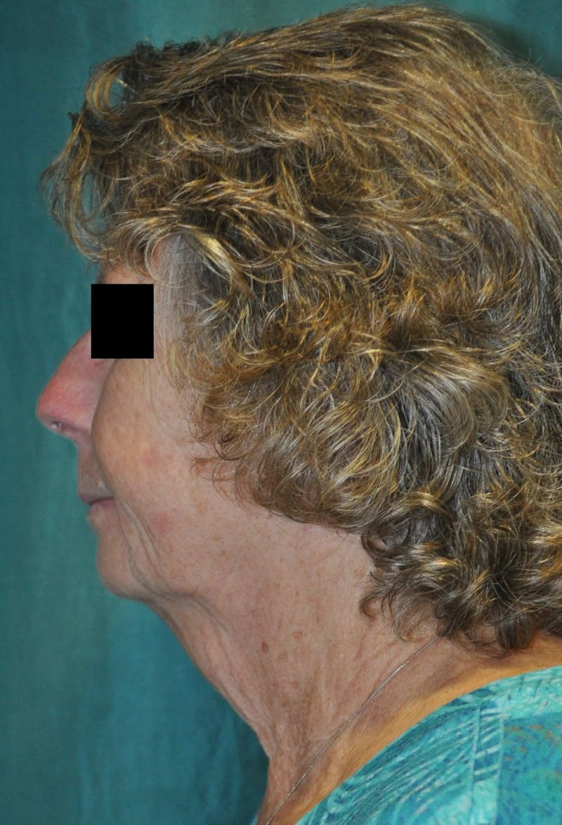 Dr. Hollie Hickman Before & After Gallery - Patient 89943091 - Image 3