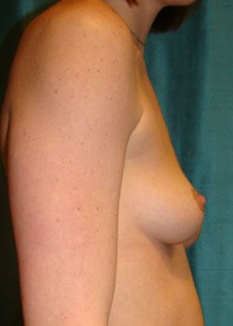 Dr. Hollie Hickman Before & After Gallery - Patient 89943704 - Image 3