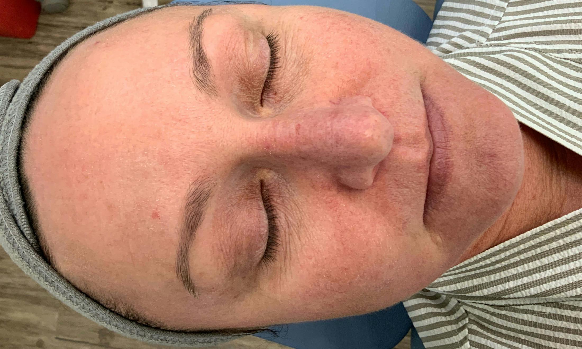 Kimberly Saffman, APRN Before & After Gallery - Patient 203476 - Image 1