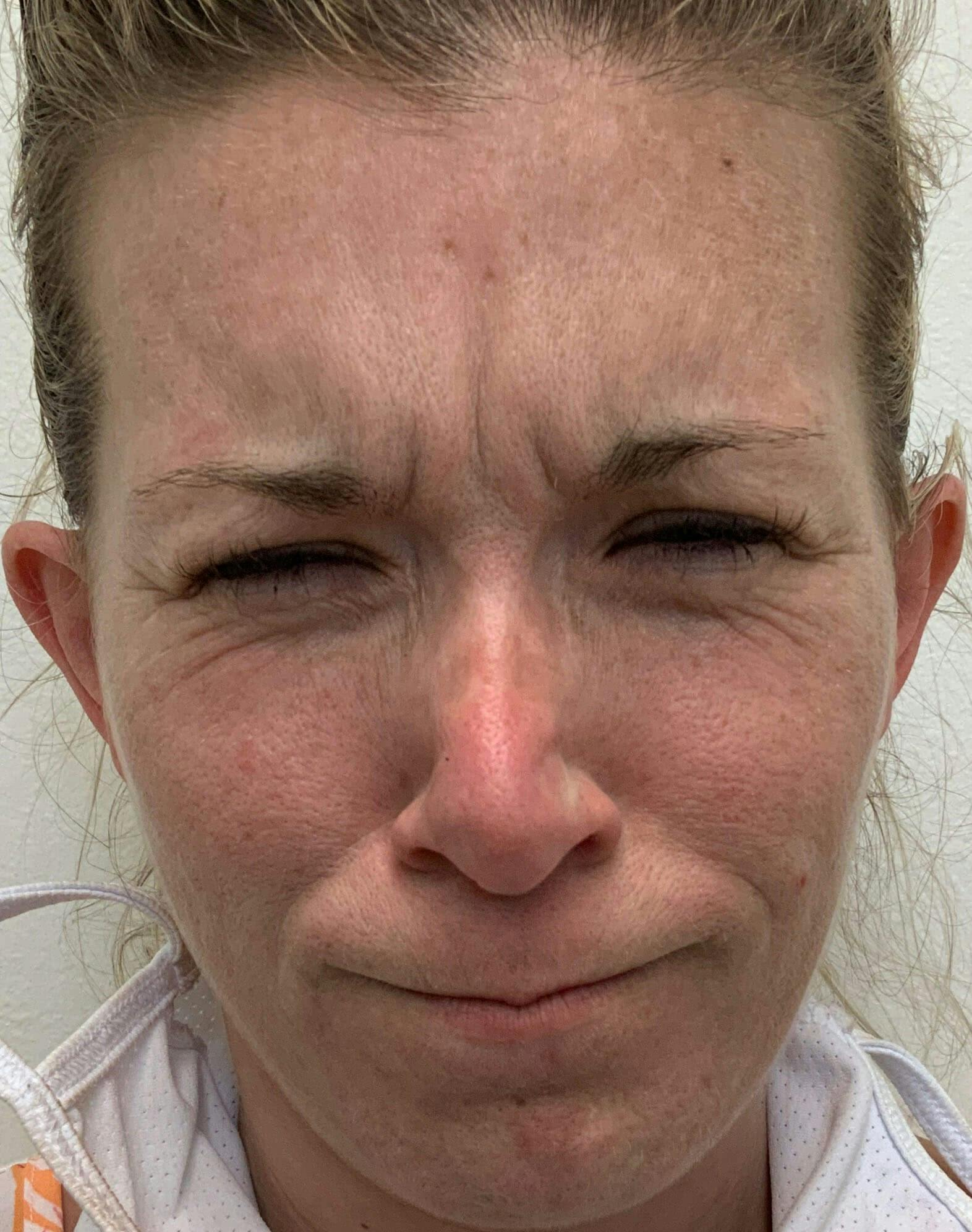 Kimberly Saffman, APRN Before & After Gallery - Patient 155695 - Image 1