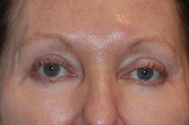 Dr. Hollie Hickman Before & After Gallery - Patient 582608 - Image 2