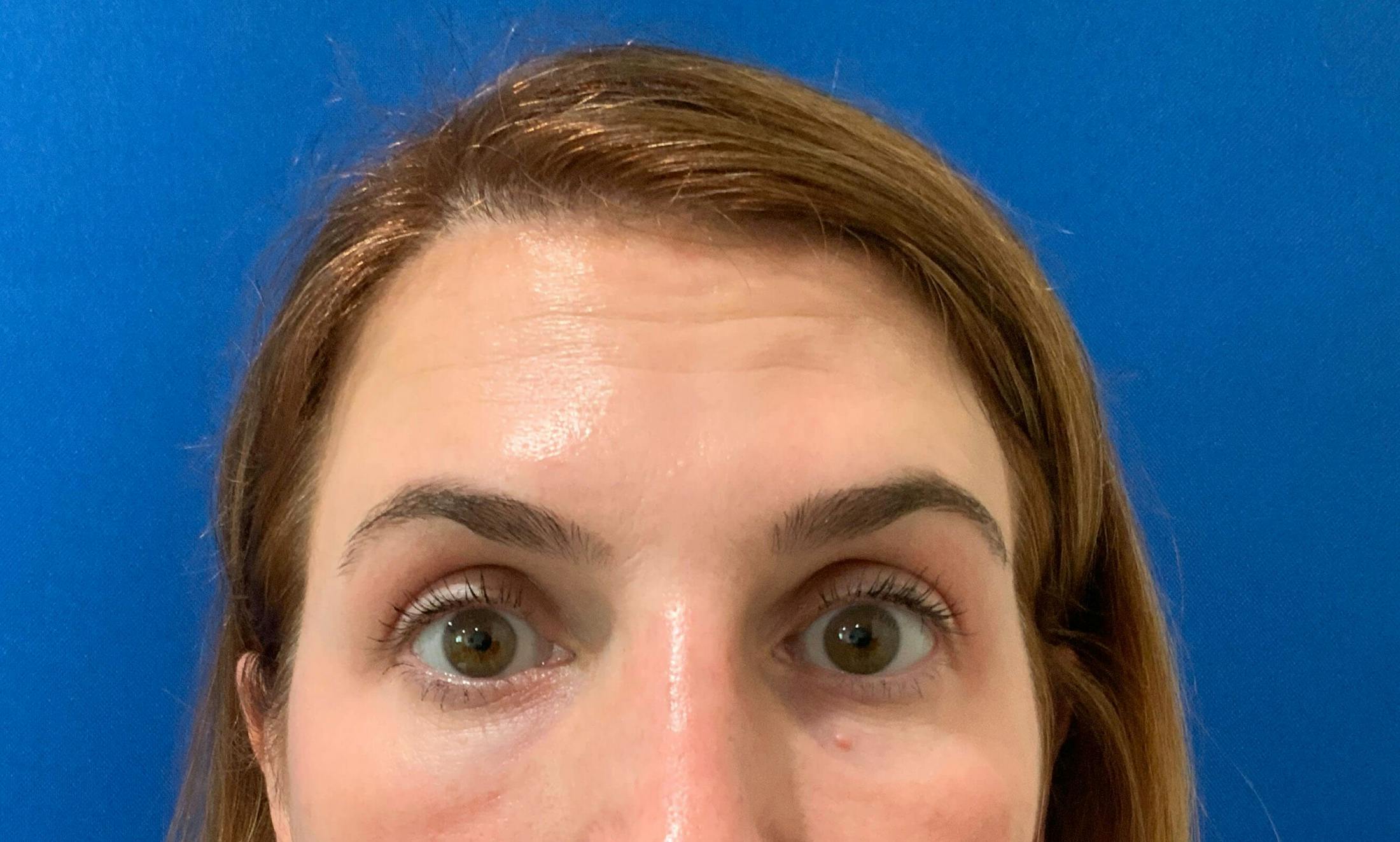 Kimberly Saffman, APRN Before & After Gallery - Patient 396521 - Image 2