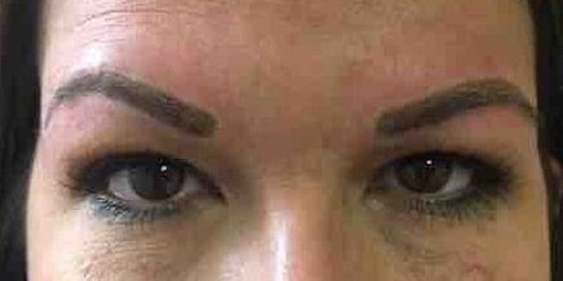 Alison Kuzoian Before & After Gallery - Patient 259746 - Image 2
