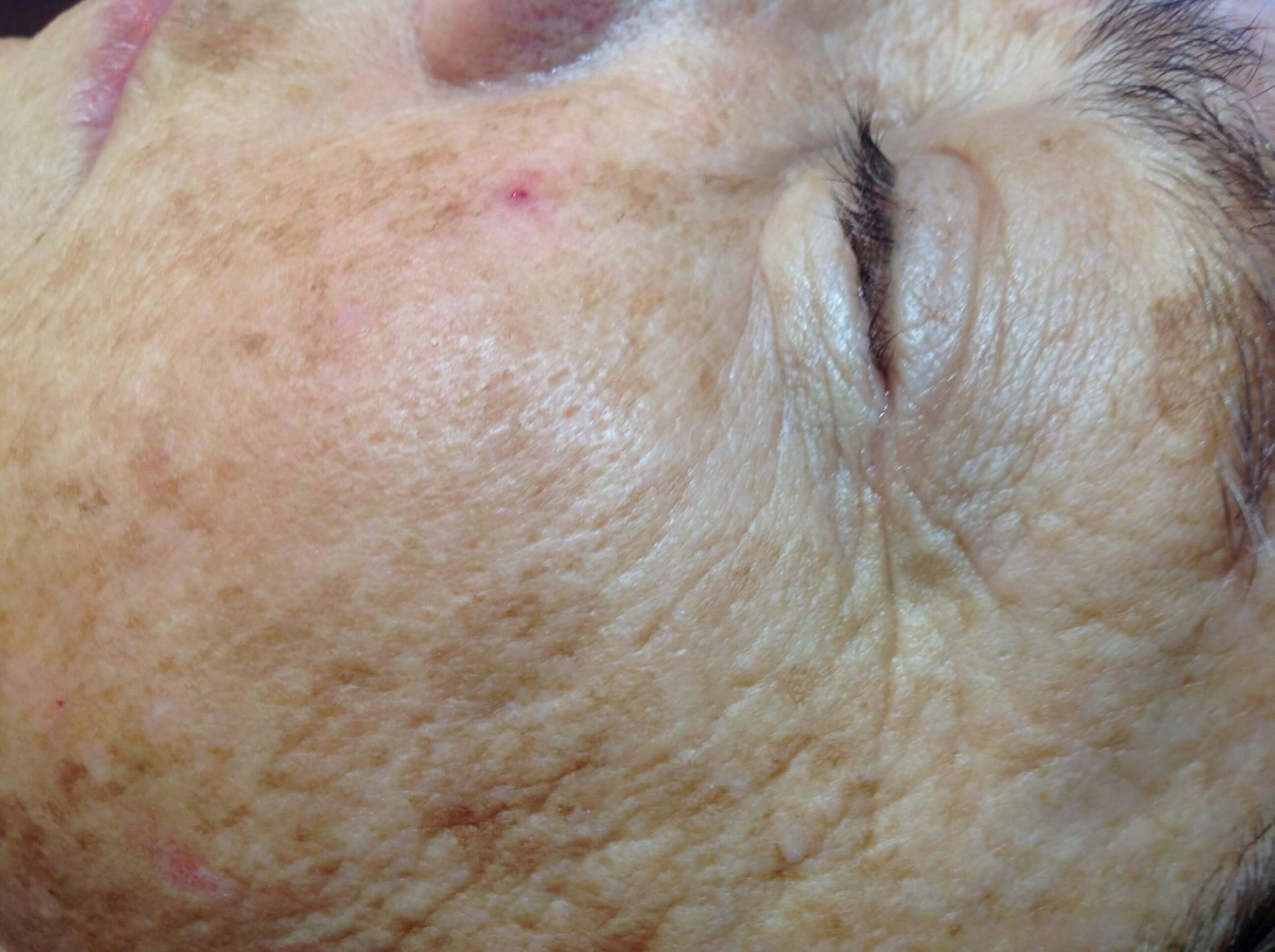 Kim Lindsey Before & After Gallery - Patient 583173 - Image 2