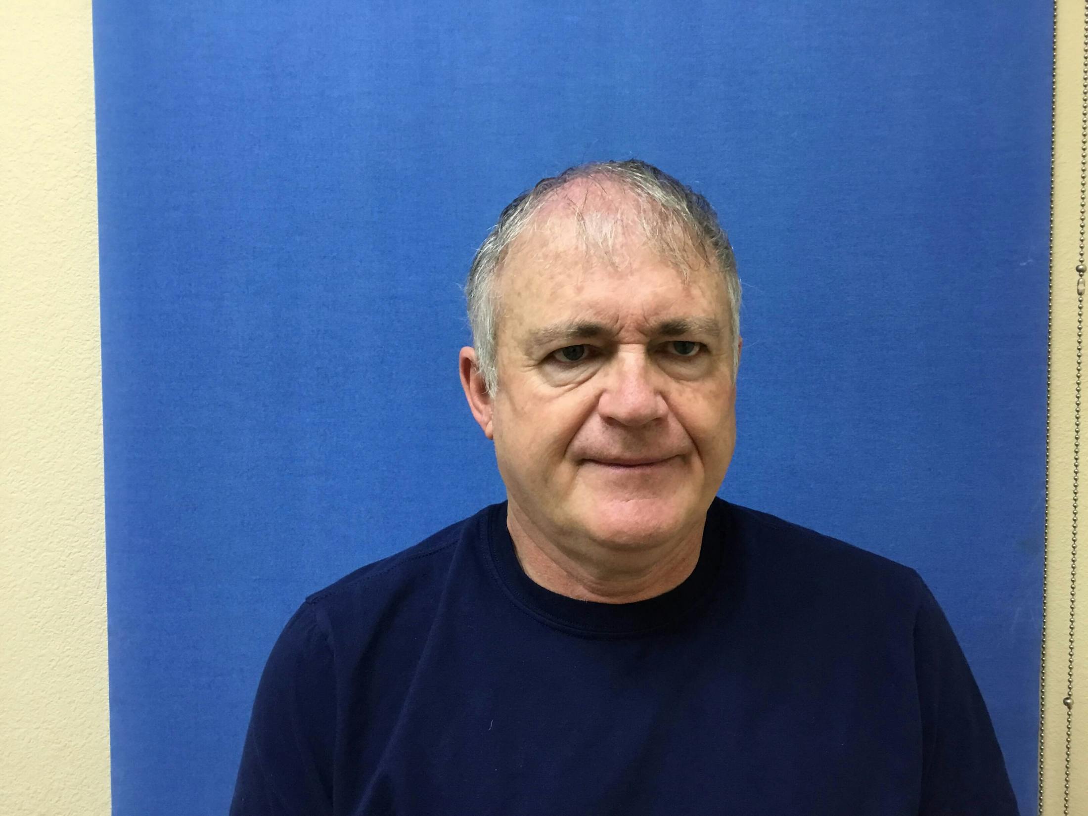 Eyelid Surgery Before & After Gallery - Patient 320321 - Image 1