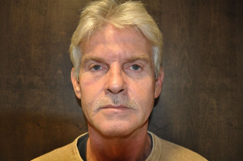 Eyelid Surgery Before & After Gallery - Patient 370575 - Image 2