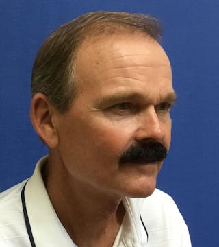 Neck Lift Before & After Gallery - Patient 221587 - Image 2