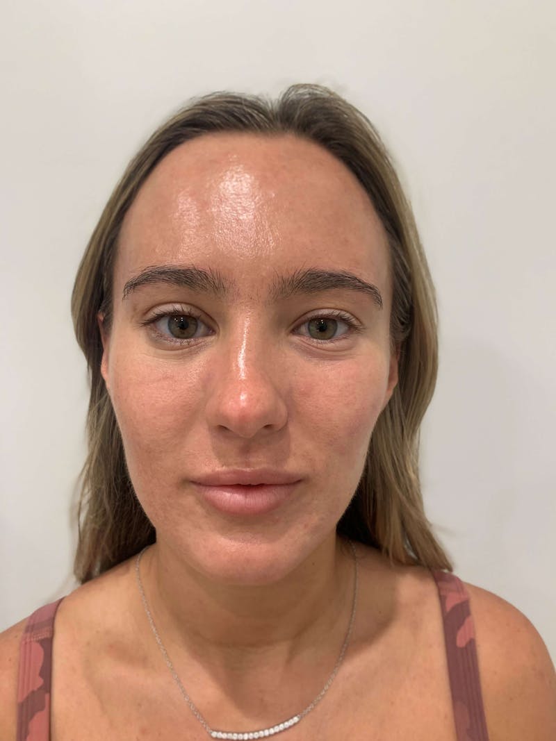 Skin Care Products Before & After Gallery - Patient 426555 - Image 2