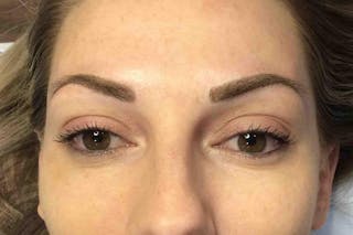 Permanent Makeup Before & After Gallery - Patient 426465 - Image 2