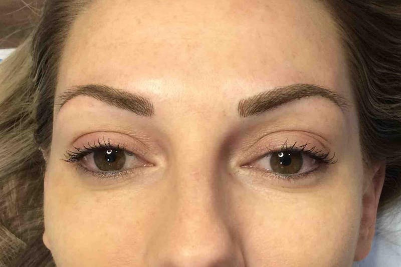 Permanent Makeup Before & After Gallery - Patient 426465 - Image 2