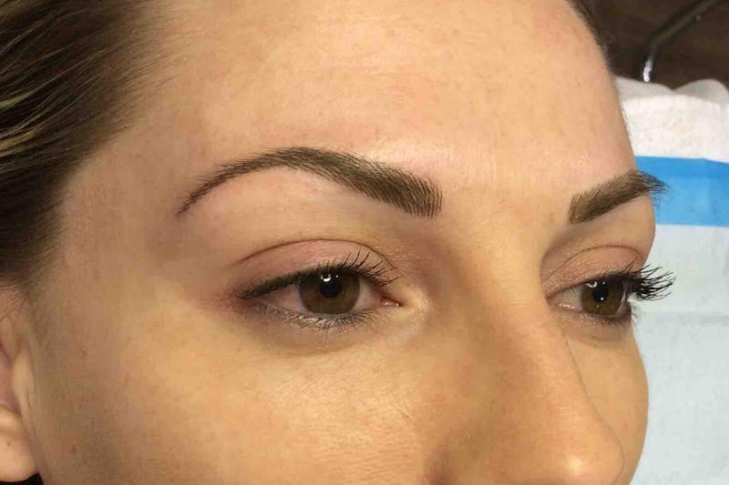 Permanent Makeup Before & After Gallery - Patient 426465 - Image 4