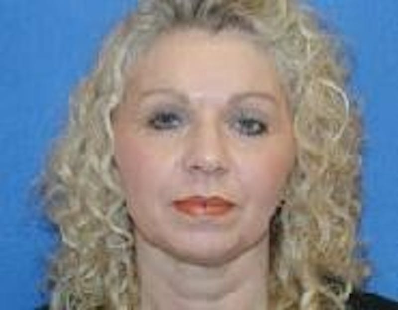 Brow Lift Before & After Gallery - Patient 294467 - Image 4
