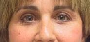 Dr. Cayce Rumsey Before & After Gallery - Patient 149499 - Image 2