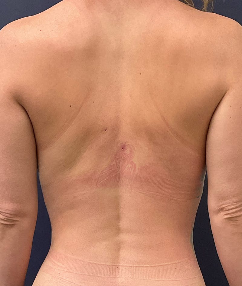 Dr. Matthew Mitchell Before & After Gallery - Patient 189640 - Image 6