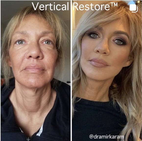 Carmel Valley Plastic Surgery