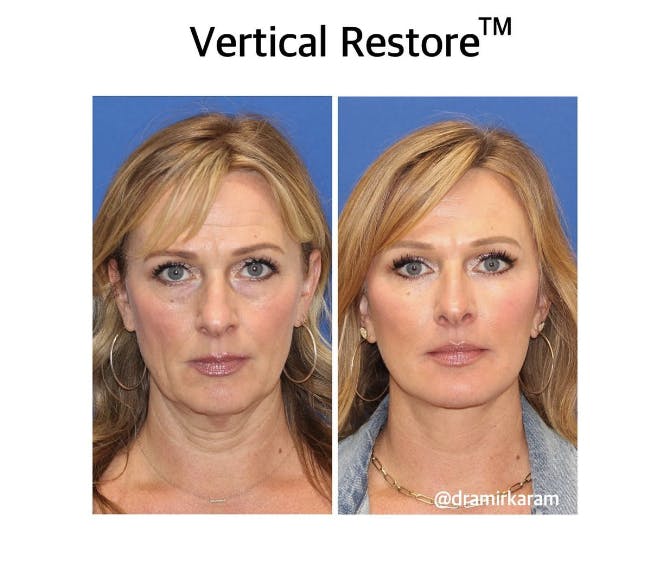 Carmel Valley Plastic Surgery