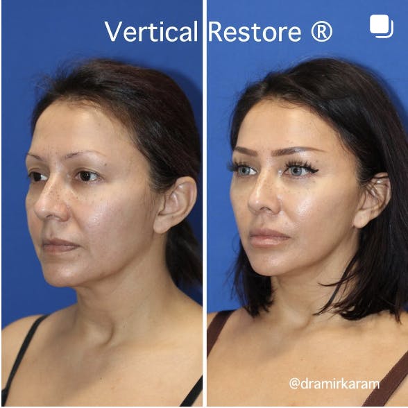Carmel Valley Plastic Surgery