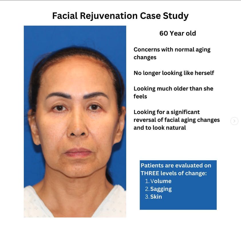 Carmel Valley Plastic Surgery