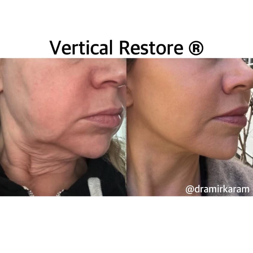 Carmel Valley Plastic Surgery
