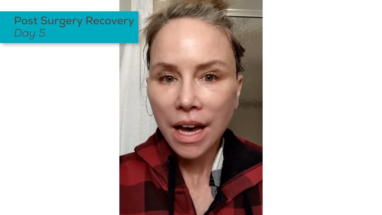 Post Surgery Day 5 