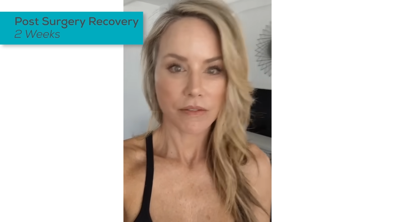 2 Weeks Post Surgery