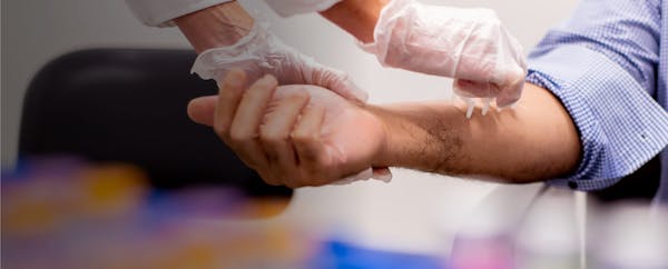 man getting allergy testing