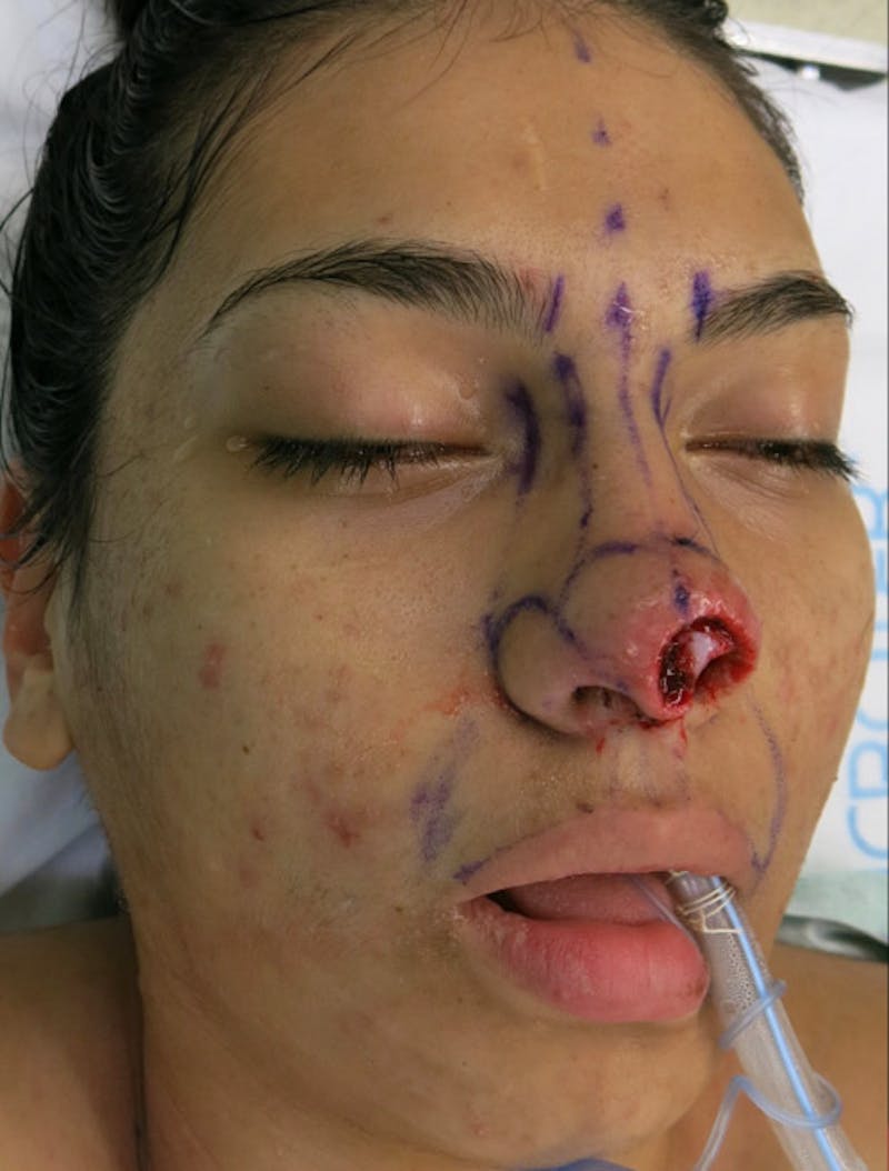 Laceration Repair Before & After Gallery - Patient 122909244 - Image 9