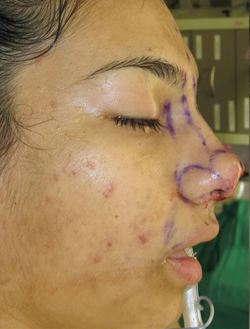 Laceration Repair Before & After Gallery - Patient 122909244 - Image 12