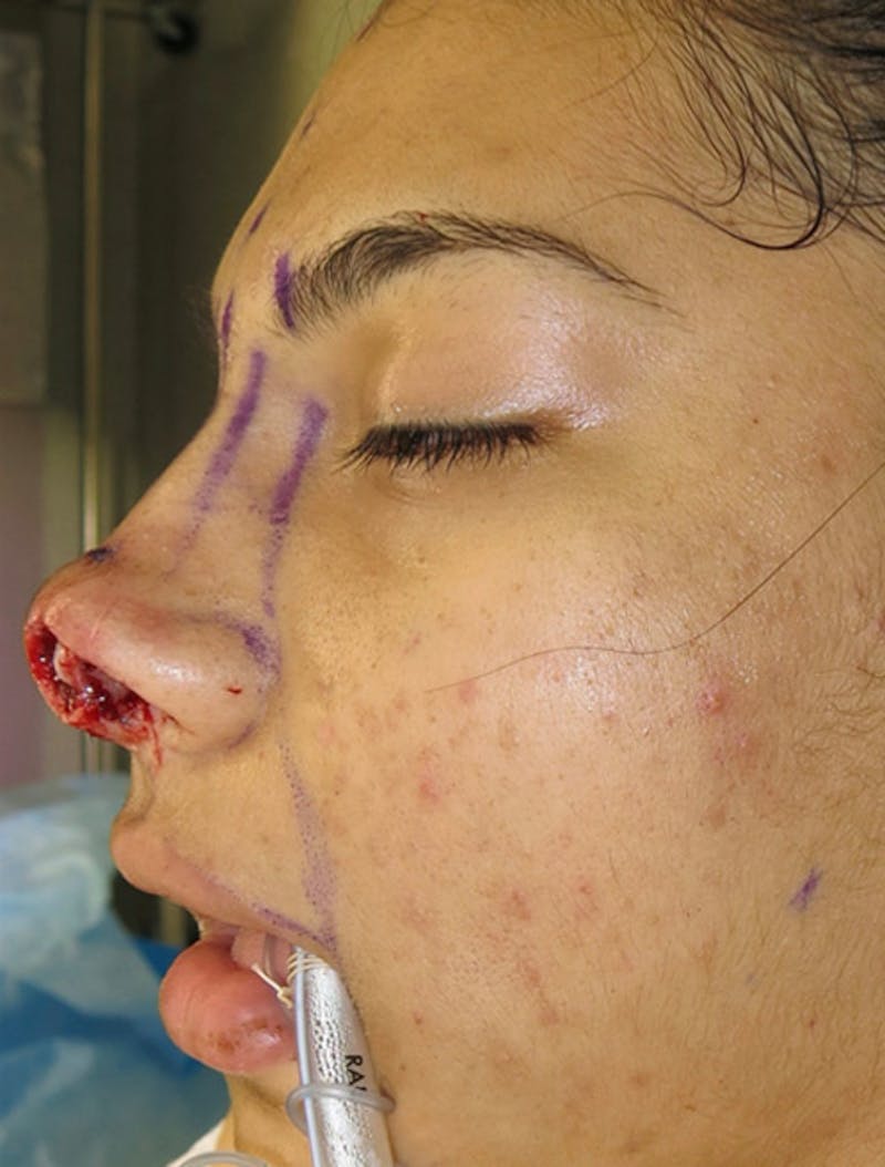 Trauma Reconstruction Before & After Gallery - Patient 122909284 - Image 7