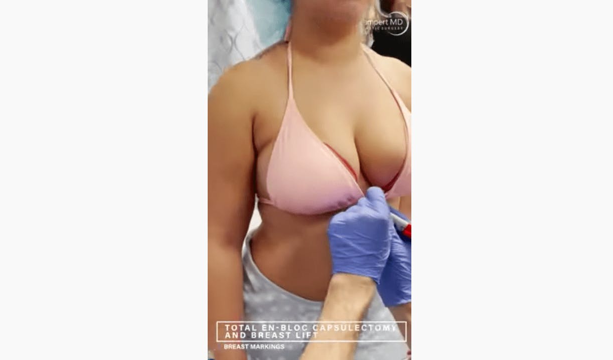 Lampert MD patient recieiving surgical consultation