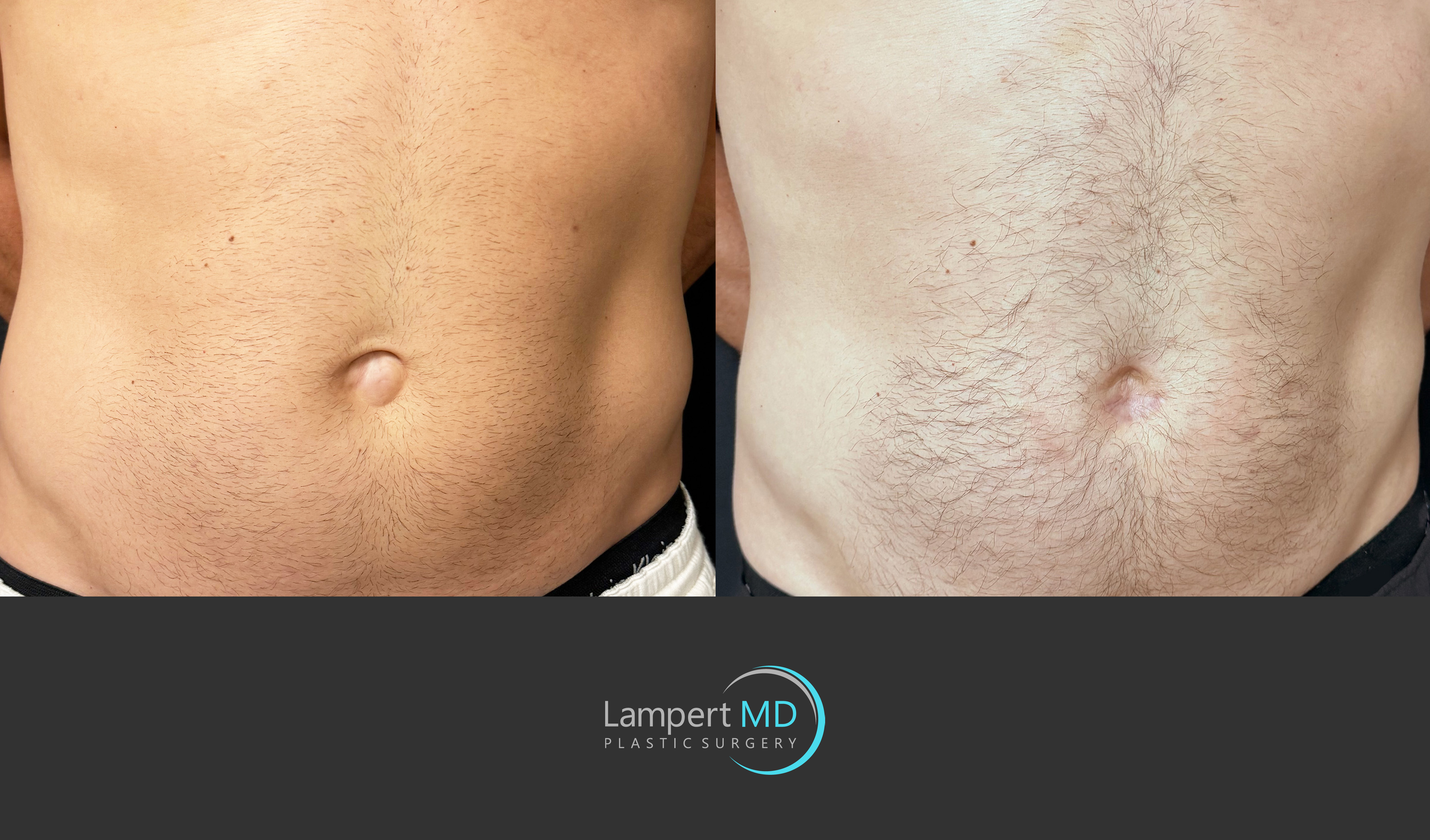 Patient 388860 | Gallery | Dr. Joshua Lampert