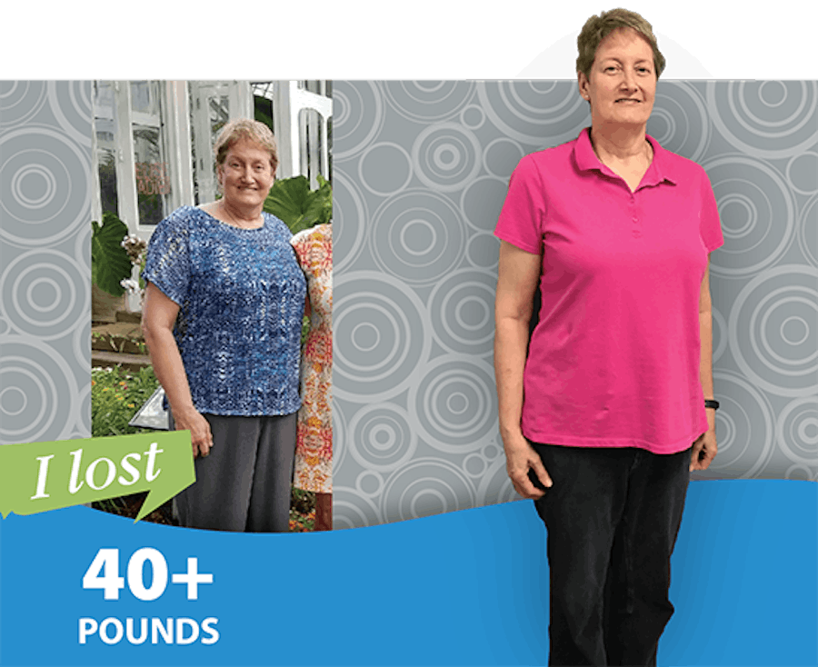 Patient loses 40+ pounds before and after photo.