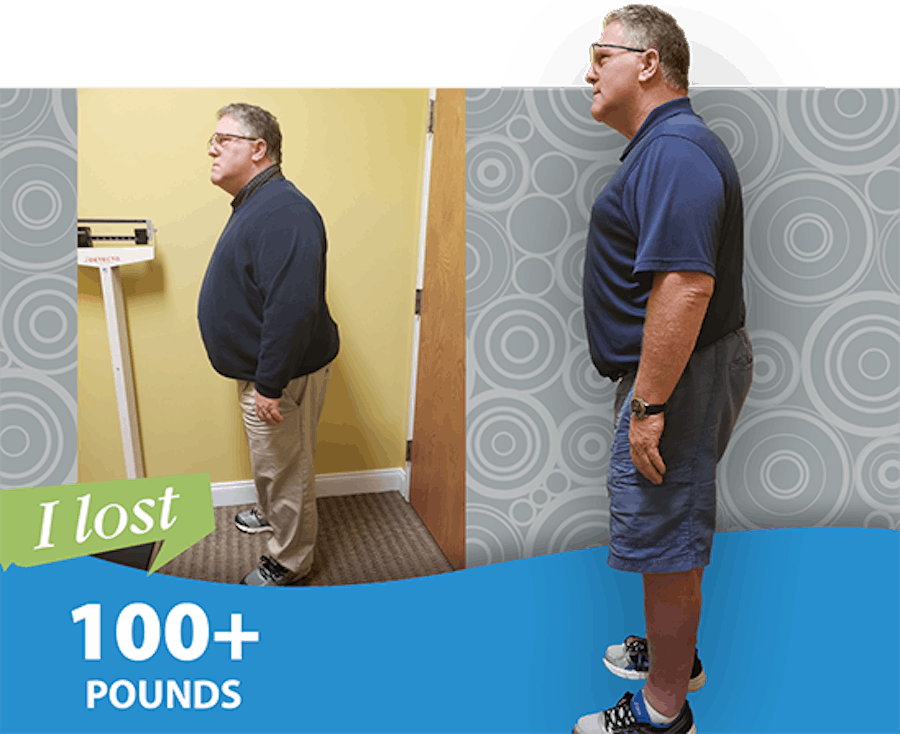 Patient loses 100+ pounds before and after photo.