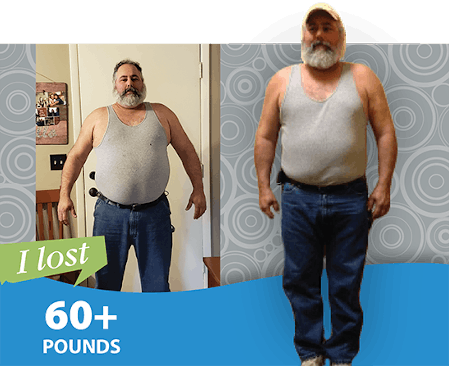 Patient loses 60+ pounds before and after photo.