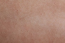 Vi hjälper dig med dina hudbesvär Vi hjälper dig med dina hudbesvär