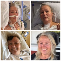 Jessica 3 veckor, 2 månader, 4 månader och 9 månader efter TBE-debuten. Jessica drabbades av TBE