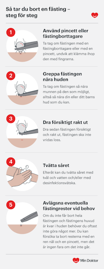 Så tar du bort en fästing Instructioner