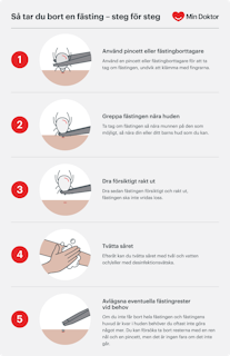 Så tar du bort en fästing Steg för steg