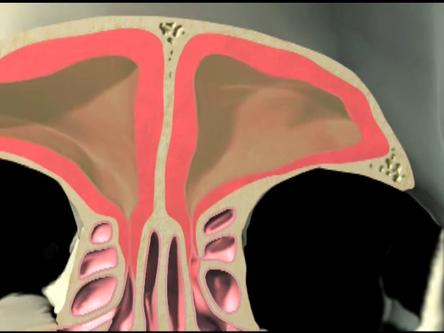 Close-up of the sinuses